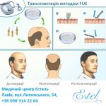 Трансплантація волосся методом FUE